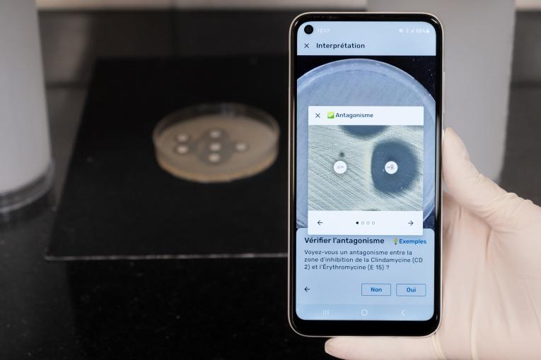 Vue de l'application Antibiogo