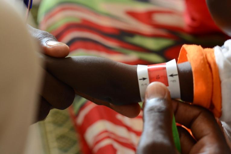 Examen du périmètre brachial d'un enfant dans la clinique MSF du camp de Zamzam, au Darfour du Nord, une étape indispensable au dépistage de la malnutrition. 