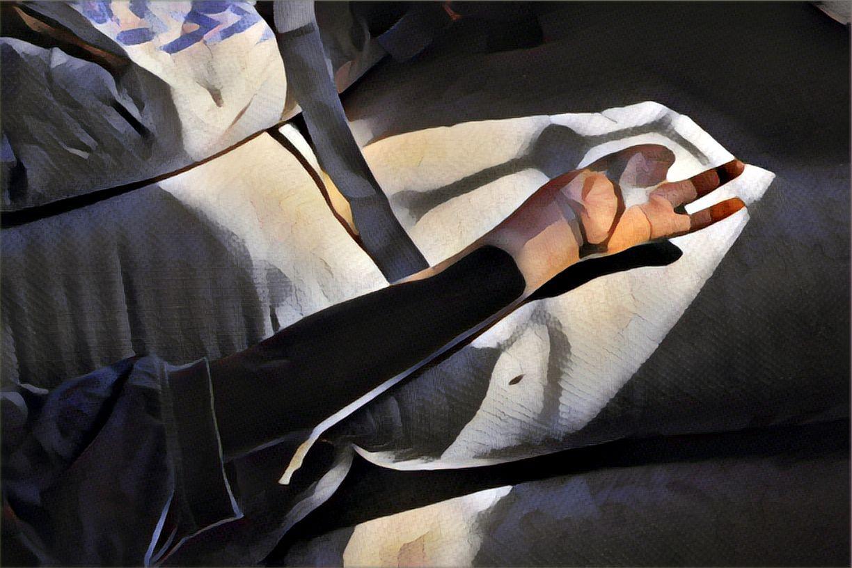 Illustration à partir d'une photographie prise par Faiz Abubaker. Le bras d'un patient, amputé d'une partie de sa main à la suite d'une explosion. Wad Madani, Soudan, décembre 2023.