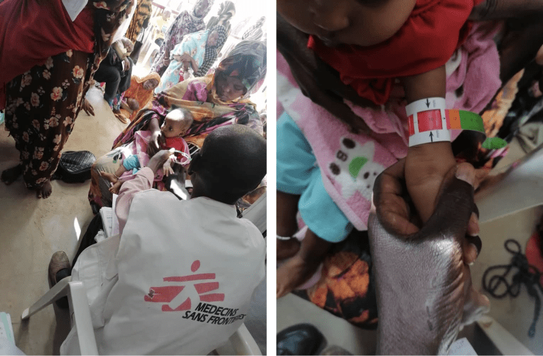 Dans le camp de Zamzam, au Soudan, MSF fait face à une crise de malnutrition catastrophique.

&nbsp;

&nbsp;

&nbsp;

&nbsp;
