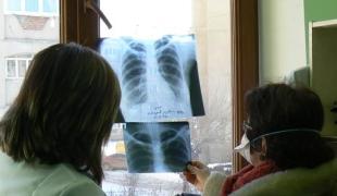 Prise en charge de la tuberculose résistante en Arménie. Andrea Bussotti/MSF
