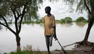 Un garçon dont la jambe a dû être amputée à la suite d'un manque d'accès au traitement après une morsure de serpent au Soudan du Sud en 2010. Cédric Gerbehaye